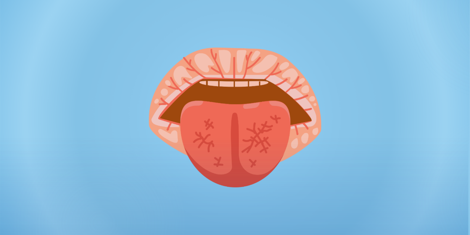 Ağız Kuruluğu (Kserostomi) ve Tükürüğün Önemli Fonksiyonları: Bilinmesi Gerekenler