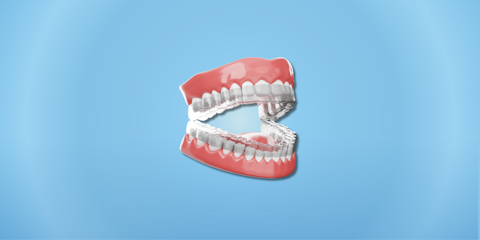 Invisalign Şeffaf Plak Kullanımında Dikkat Edilmesi Gerekenler: Kapsamlı Klinik ve Hasta Rehberi