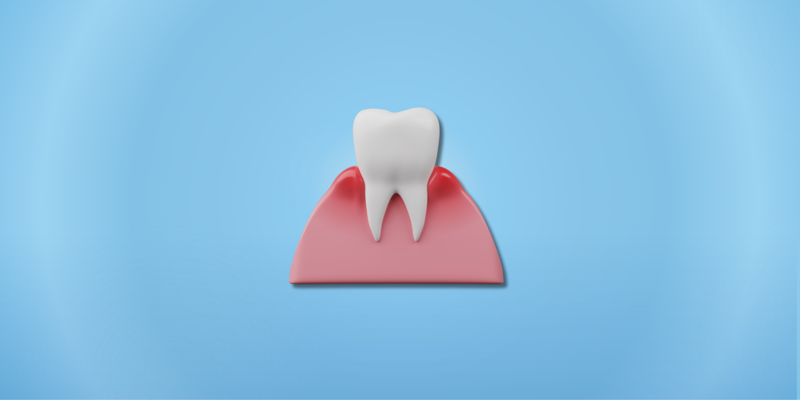 Diş Eti İltihabı ve Diş Sallanması (Periodontitis): Neden Olur, Nasıl Tedavi Edilir?